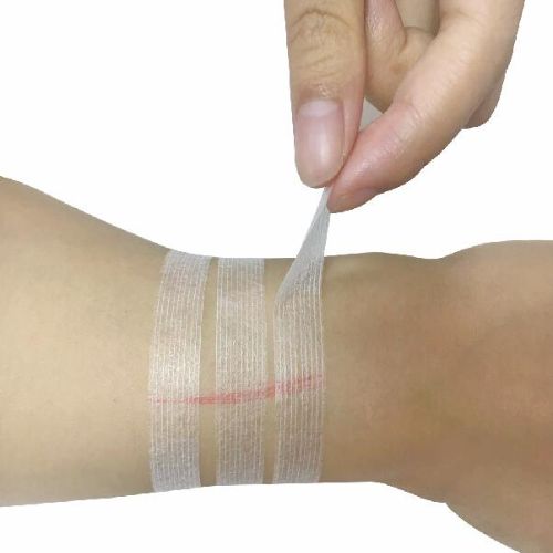 Wound Closure Tape